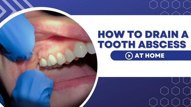 6 Best Ways to Drain a Tooth Abscess at Home