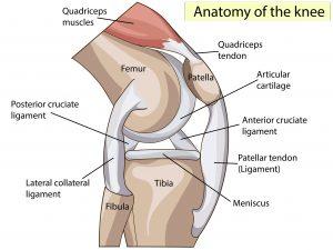 How to Heal a Torn Meniscus Naturally