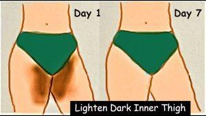 How to lighten inner thighs